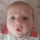 Cleft Palate